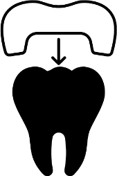 Procedimento dentário Próteses